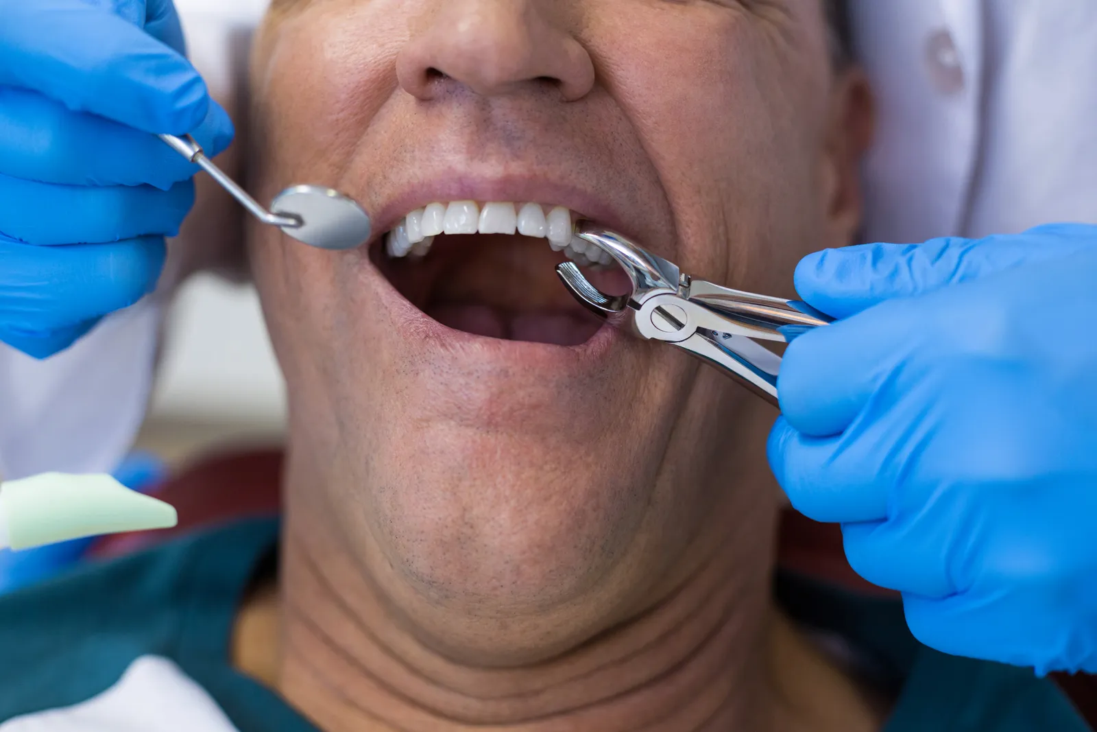 Tooth Extraction Ridge DentalCube | Premium Dental Care Kellyville Ridge