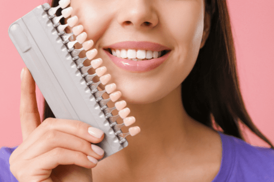 VENEER SHADE
